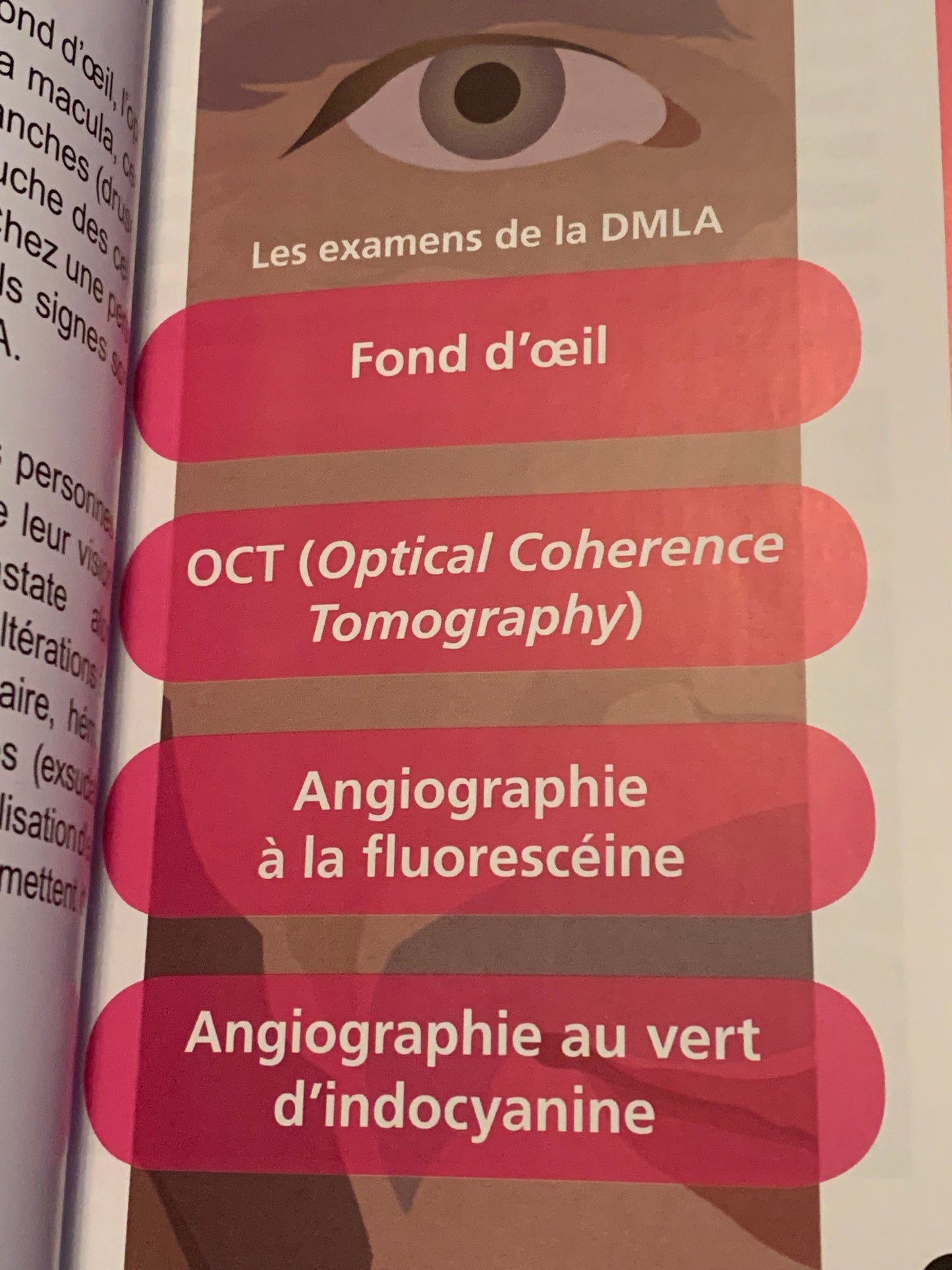 Livre : DMLA Dégénérescence maculaire liée à l'âge - Guide à l'usage des patients et de leur entourage | Editions MEDICA LIBRIS EDITIONS