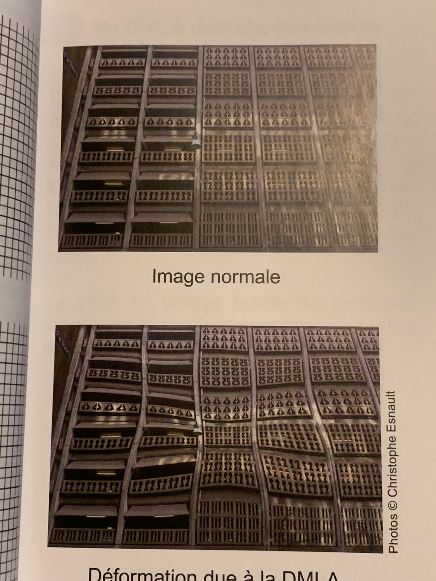 Livre : DMLA Dégénérescence maculaire liée à l'âge - Guide à l'usage des patients et de leur entourage | Editions MEDICA LIBRIS EDITIONS