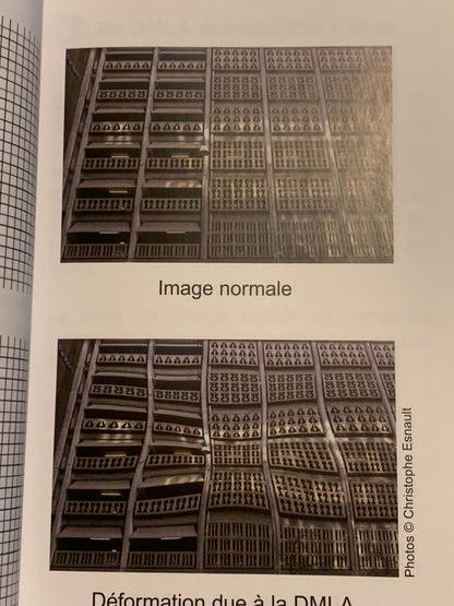 Livre : DMLA Dégénérescence maculaire liée à l'âge - Guide à l'usage des patients et de leur entourage | Editions MEDICA LIBRIS EDITIONS